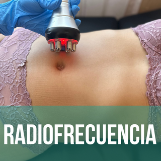 Radiofrecuencia corporal x 6